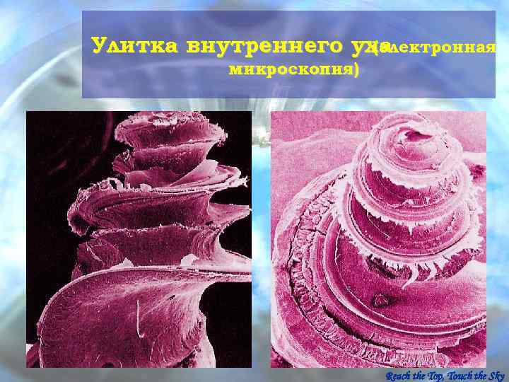 Улитка внутреннего уха     (электронная  микроскопия)    