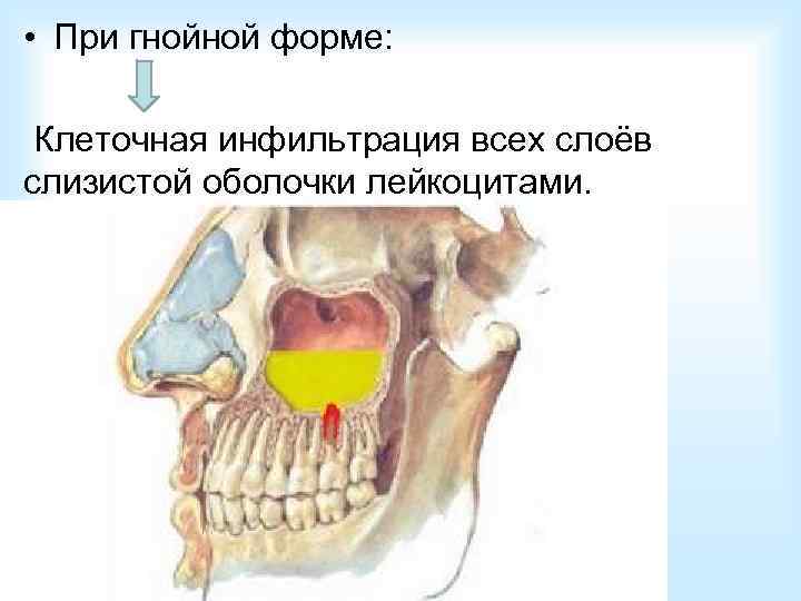 Правая верхнечелюстная пазуха где находится картинка