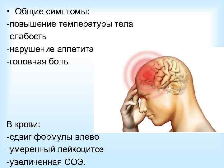 Диагностика острого гайморита: 