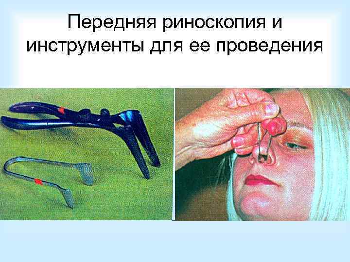 Эндоскопическое исследование   полости носа 