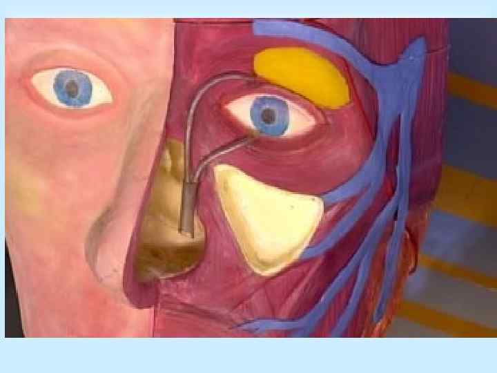 Классификация гайморита:  Односторонний  Двухсторонний 