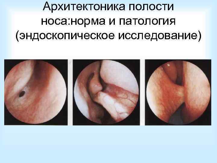 Рентгенологическое  исследование 