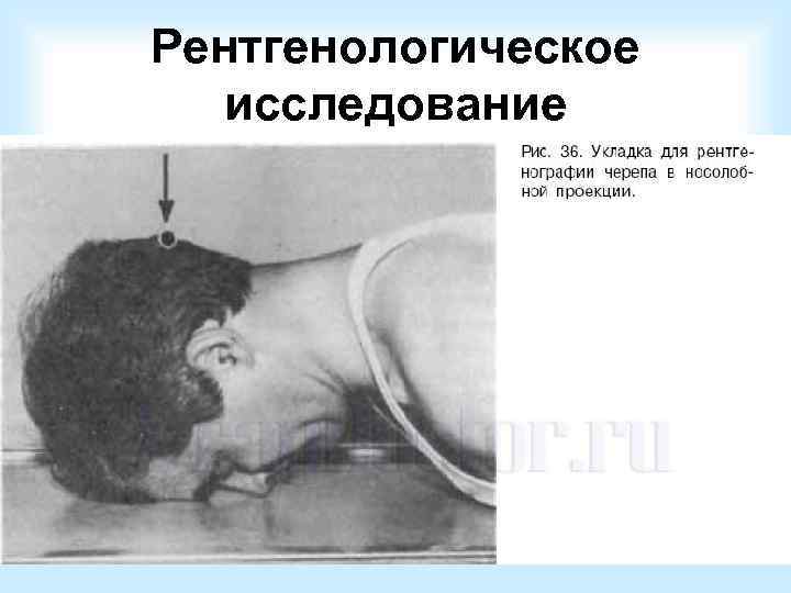 Диагностическая пункция: 