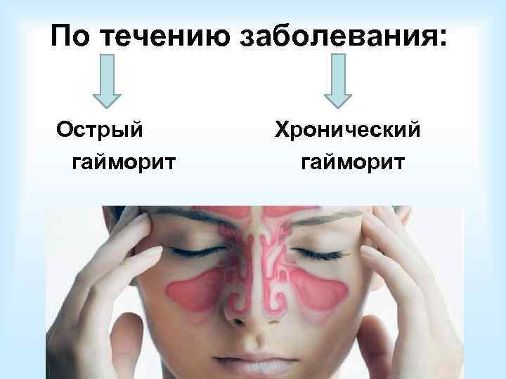  По морфологическим   изменениям:   1. Экссудативная форма (острая  