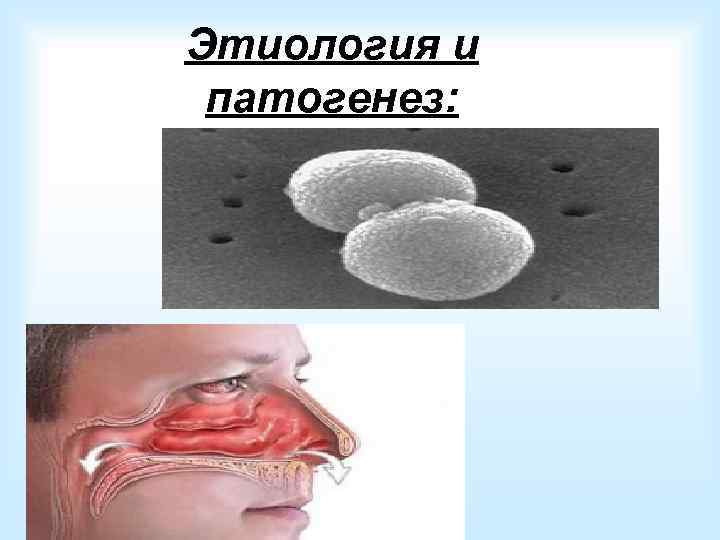  • Состояние местного и общего  иммунитета • ОРЗ и ОРВИ • Острые