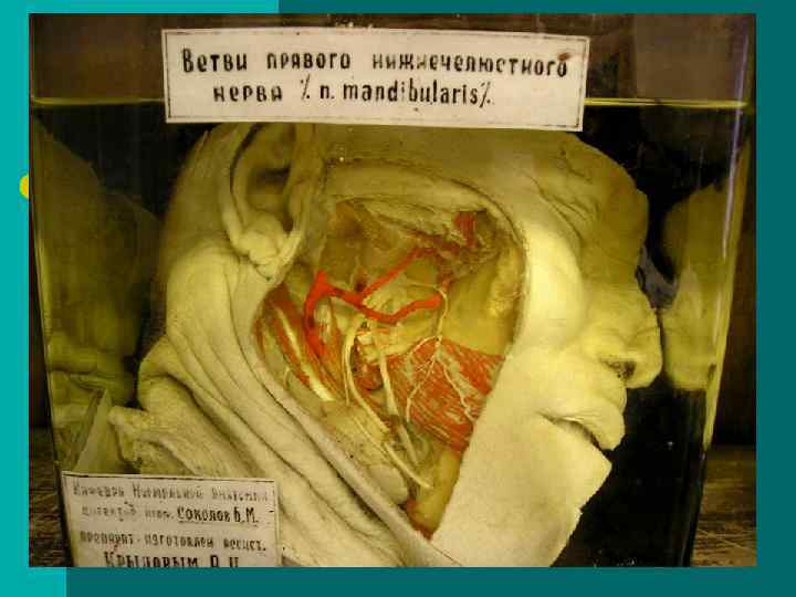 VII — лицевой нерв, n. facialis l вступает в пирамиду височной кости через VII — лицевой нерв, n. facialis l вступает в пирамиду височной кости через