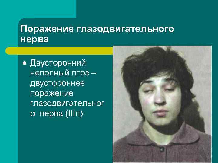 Ситуационные задачи 2. Больной с сахарным диабетом предъявляет жалобы на двоение, усиливающееся при Ситуационные задачи 2. Больной с сахарным диабетом предъявляет жалобы на двоение, усиливающееся при