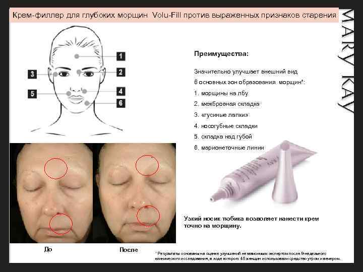 Крем-филлер для глубоких морщин Volu-Fill против выраженных признаков старения Преимущества: Значительно улучшает внешний вид