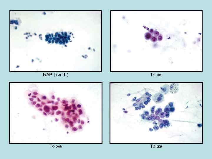 БАР (тип II) То же 