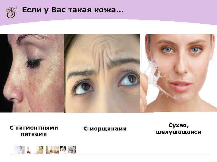 Если у Вас такая кожа… С пигментными пятнами С морщинами Сухая, шелушащаяся 