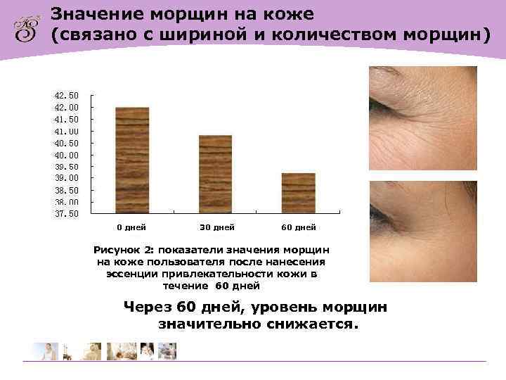 Значение морщин на коже (связано с шириной и количеством морщин) 0 дней 30 дней
