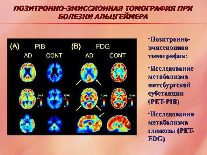 ПЭТ с Питсбургской субстанцией Р 