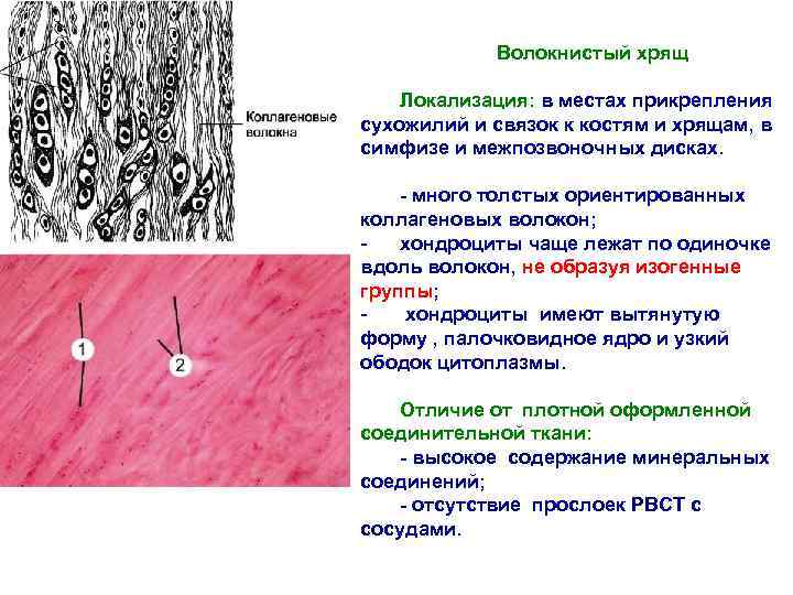 Волокнистый хрящ Локализация: в местах прикрепления сухожилий и связок к костям и хрящам, в