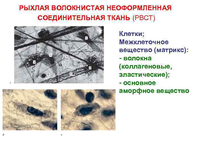РЫХЛАЯ ВОЛОКНИСТАЯ НЕОФОРМЛЕННАЯ СОЕДИНИТЕЛЬНАЯ ТКАНЬ (РВСТ) Клетки; Межклеточное вещество (матрикс): - волокна (коллагеновые, эластические);