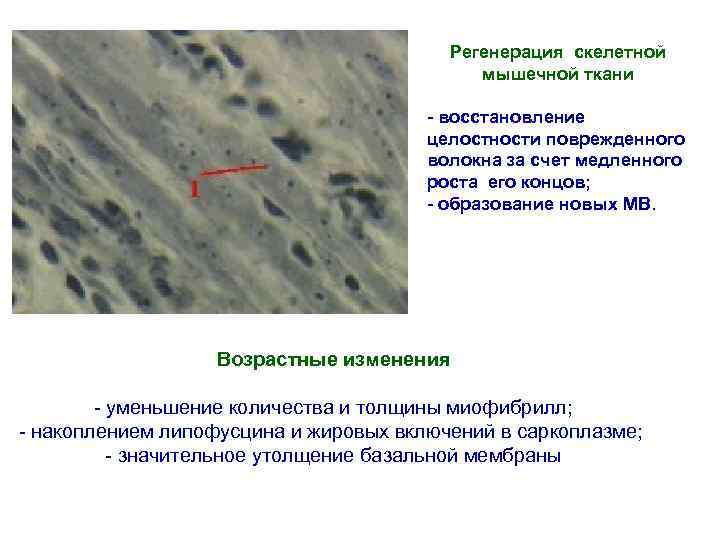 Регенерация скелетной мышечной ткани - восстановление целостности поврежденного волокна за счет медленного роста его