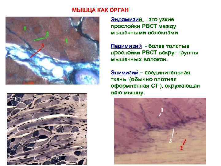 МЫШЦА КАК ОРГАН Эндомизий - это узкие прослойки РВСТ между мышечными волокнами. Перимизий -