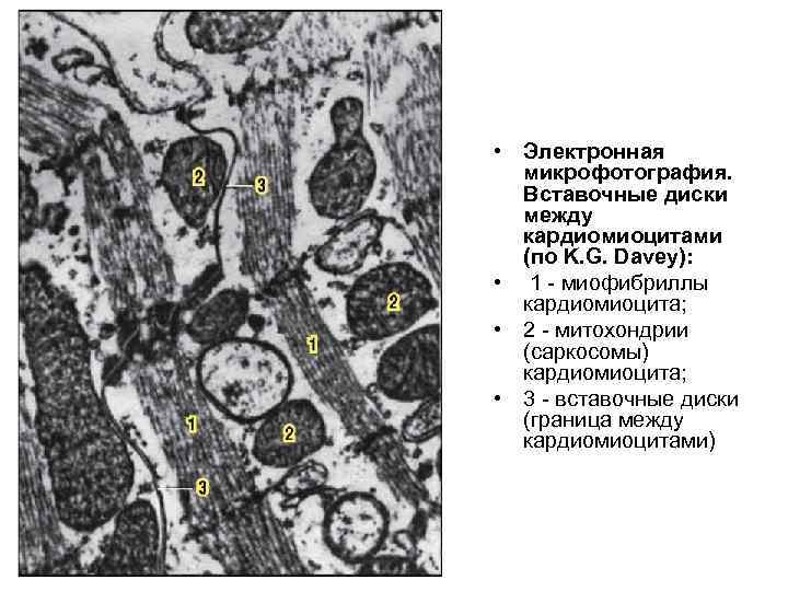  • Электронная микрофотография. Вставочные диски между кардиомиоцитами (по K. G. Davey): • 1