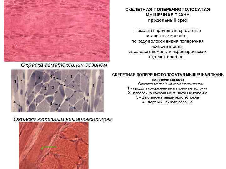 СКЕЛЕТНАЯ ПОПЕРЕЧНОПОЛОСАТАЯ МЫШЕЧНАЯ ТКАНЬ продольный срез Показаны продольно-срезанные мышечные волокна; по ходу волокон видна