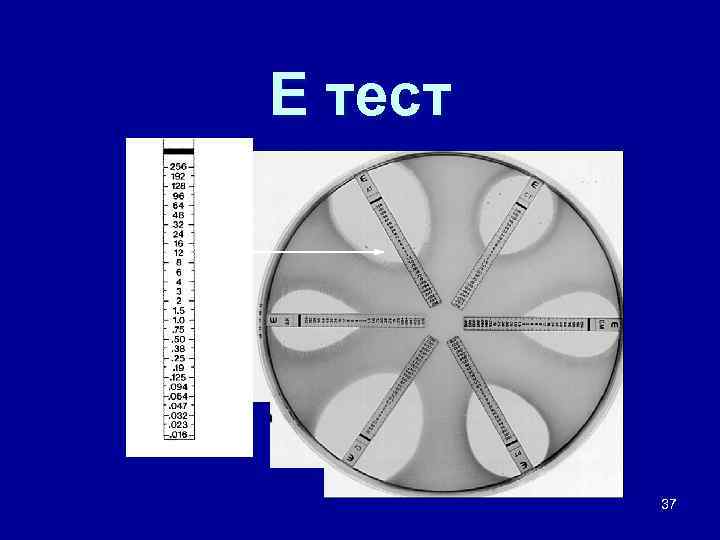 Е тест 37 