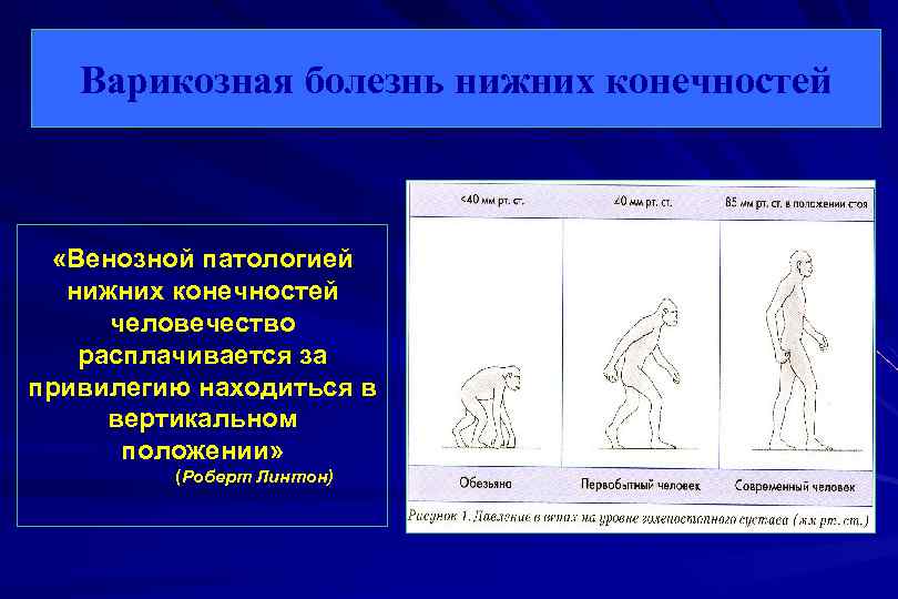 Варикозная болезнь нижних конечностей код по мкб 10 фото