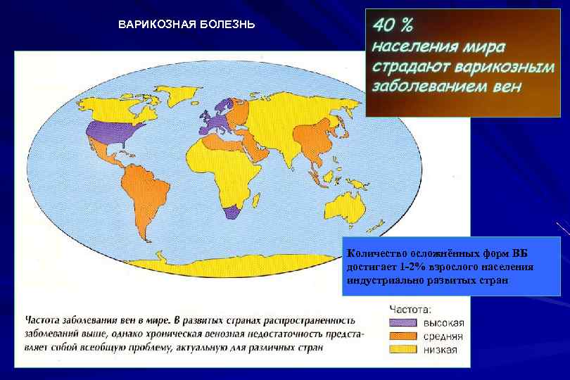 ВАРИКОЗНАЯ БОЛЕЗНЬ Количество осложнённых форм ВБ достигает 1 -2% взрослого населения индустриально развитых стран