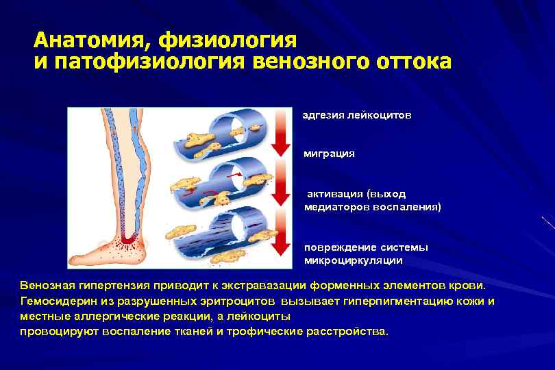 Укрепление венозной стенки