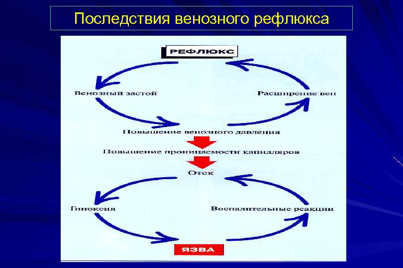 Последствия венозного рефлюкса 