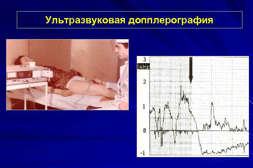 Ультразвуковая допплерография 