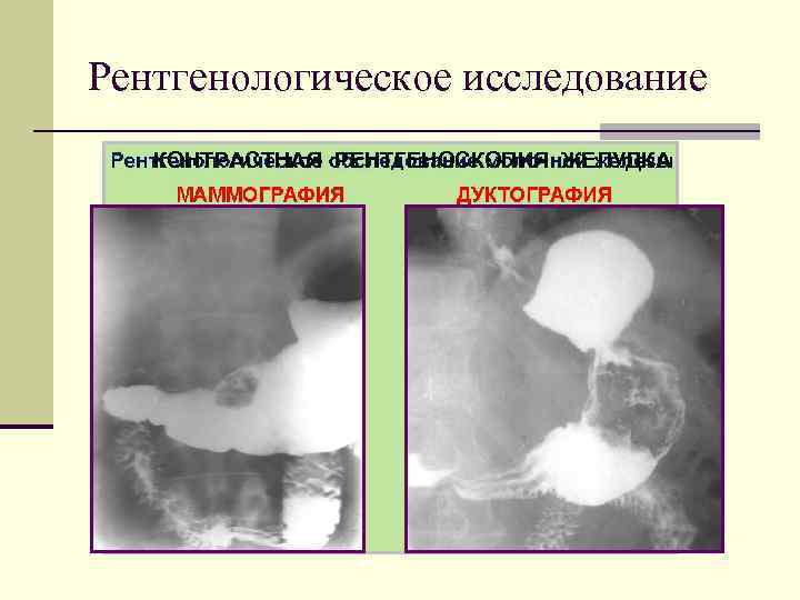 Рентгенологическое исследование КОНТРАСТНАЯ РЕНТГЕНОСКОПИЯ ЖЕЛУДКА 