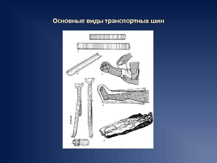 Основные виды транспортных шин 