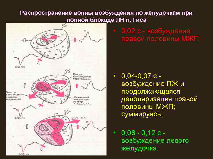 Волна возбуждения. Распространение возбуждения по желудочкам. Распределение волн возбуждения. Проведение возбуждения по желудочкам. Распространение волны возбуждения при блокаде левой ножки.