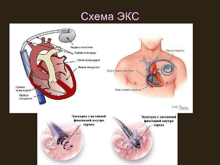 Схема ЭКС 