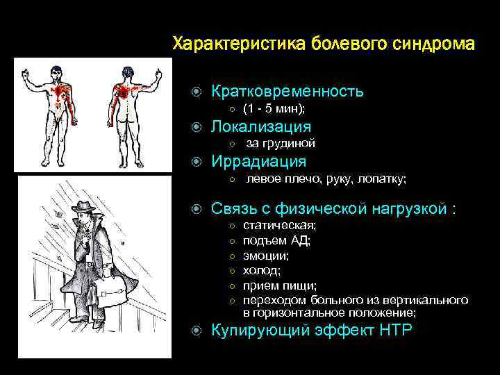 Характеристика болевого синдрома Кратковременность ○ (1 - 5 мин); Локализация ○ за грудиной Иррадиация