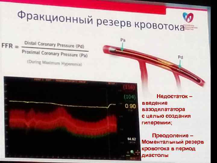  Недостаток – введение вазодялататора с целью создания гиперемии; Преодоление – Моментальный резерв кровотока