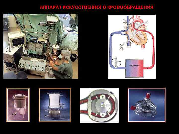 Схема системы экстракорпорального кровообращения