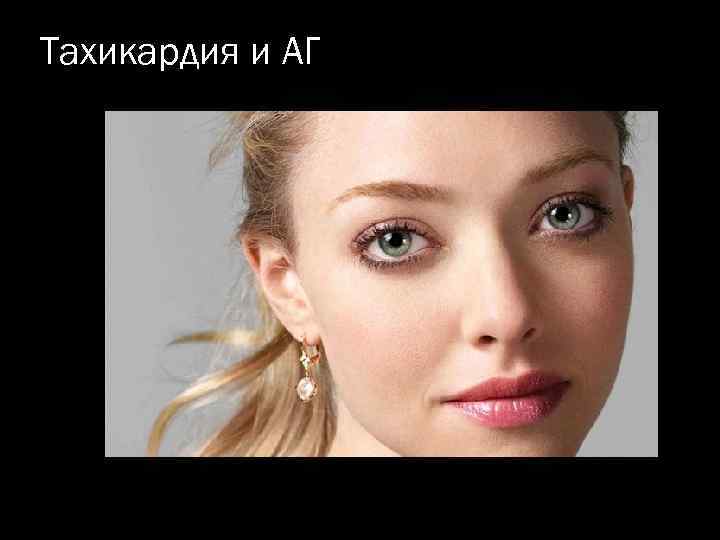 Тахикардия и АГ 