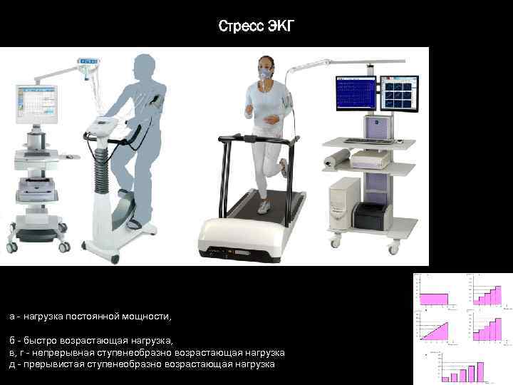 Стресс ЭКГ а - нагрузка постоянной мощности, б - быстро возрастающая нагрузка, в, г