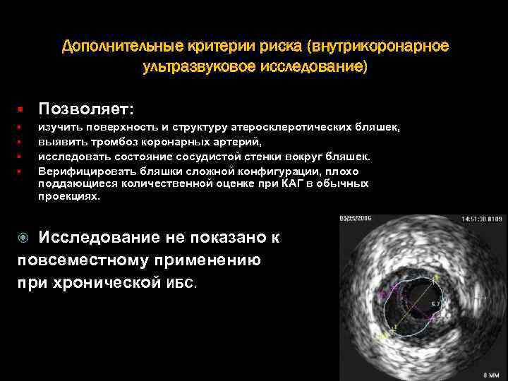 Дополнительные критерии риска (внутрикоронарное ультразвуковое исследование) § Позволяет: § изучить поверхность и структуру атеросклеротических