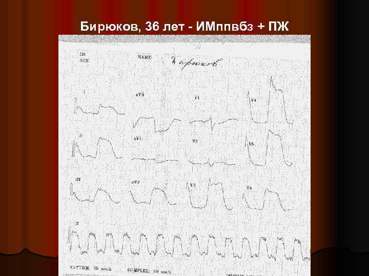 Бирюков, 36 лет - ИМппвбз + ПЖ 