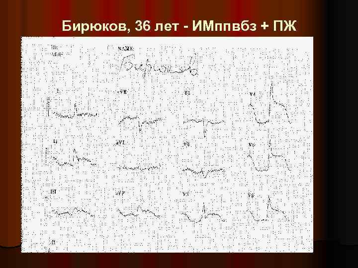 Бирюков, 36 лет - ИМппвбз + ПЖ 