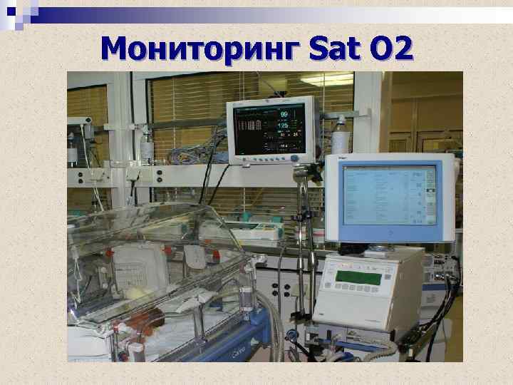 Мониторинг Sat O 2 
