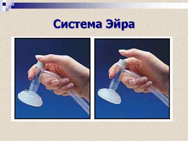 Система Эйра 