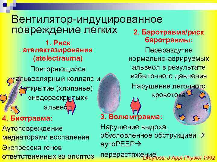 Вентилятор-индуцированное повреждение легких 2. Баротравма/риск 1. Риск ателектазирования (atelectrauma) Повторяющийся альвеолярный коллапс и открытие