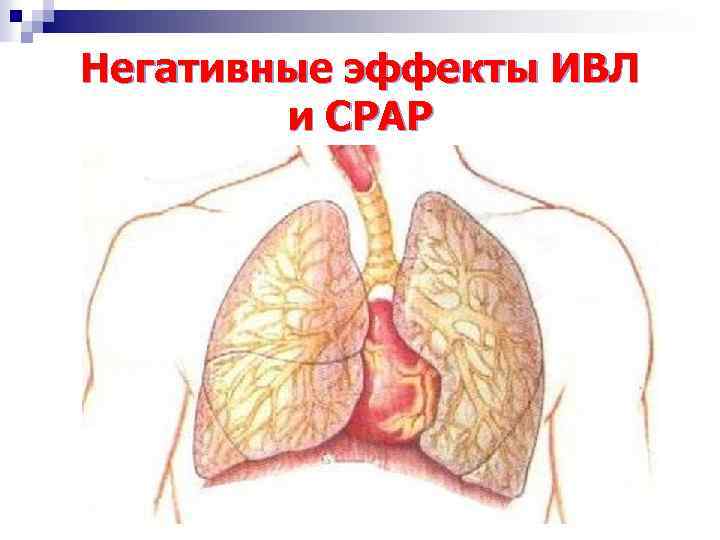 Негативные эффекты ИВЛ и СРАР 