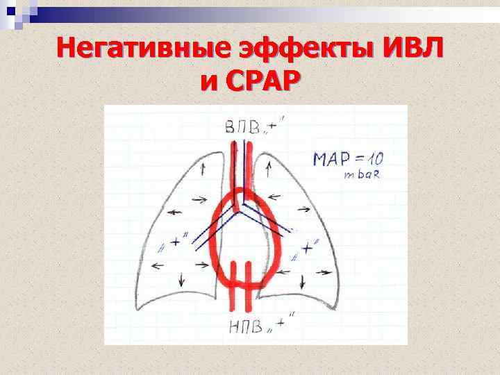 Негативные эффекты ИВЛ и СРАР 