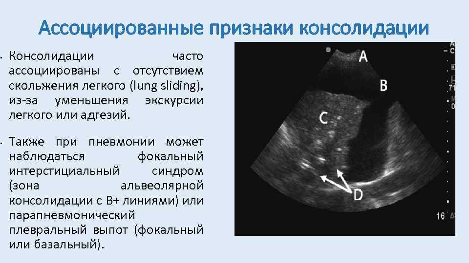 Узи легких