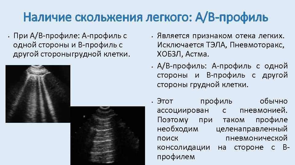 Узи легких протокол и плевры образец