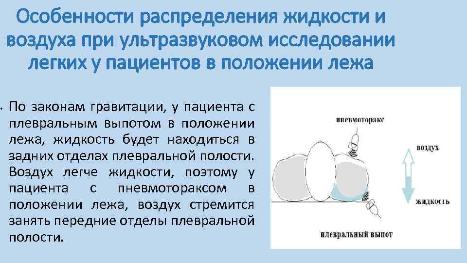 Особенности распределения жидкости и воздуха при ультразвуковом исследовании легких у пациентов в положении лежа