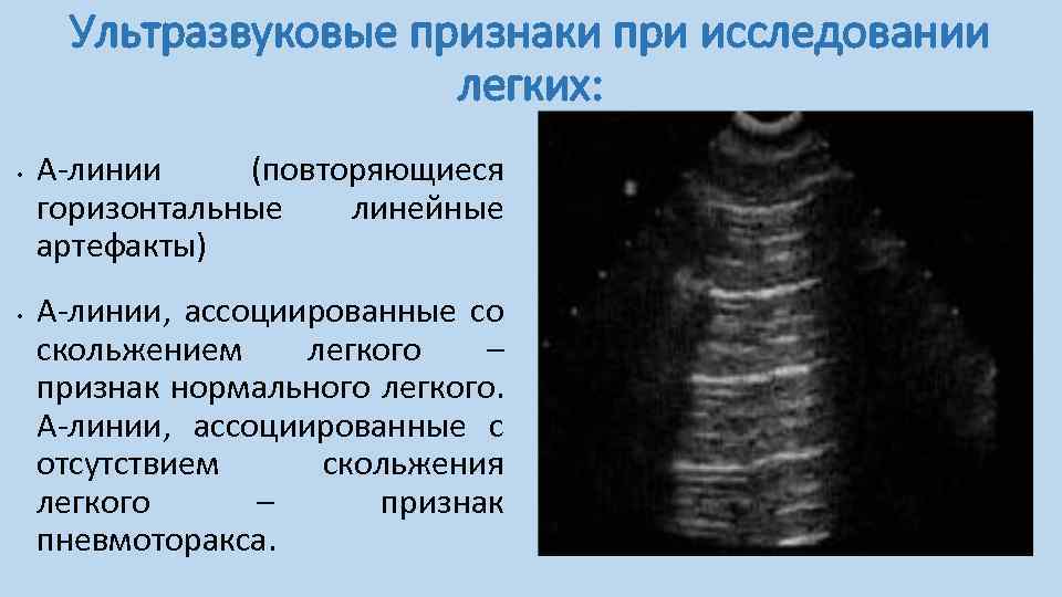 Teso исследование столяра гленумбра