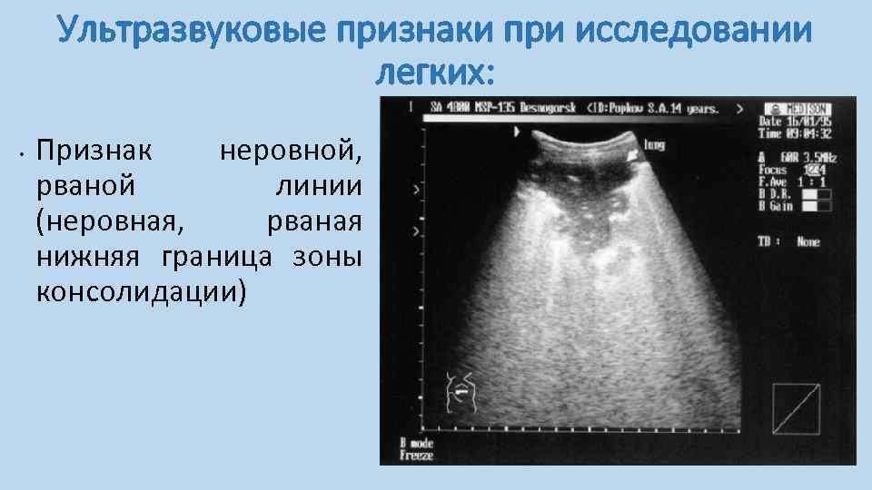 Ультразвуковое исследование презентация